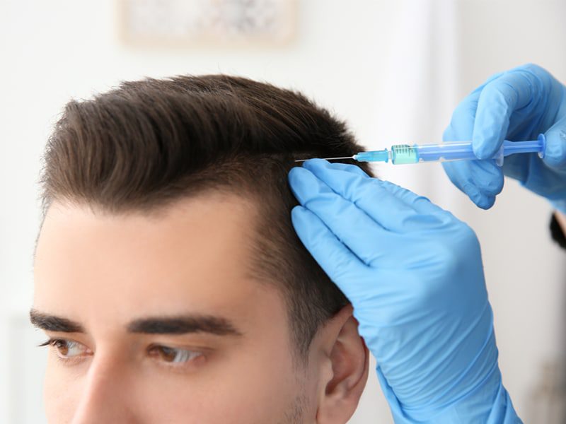 Patient receiving PRP injections for hair loss treatment, showcasing the non-surgical procedure.